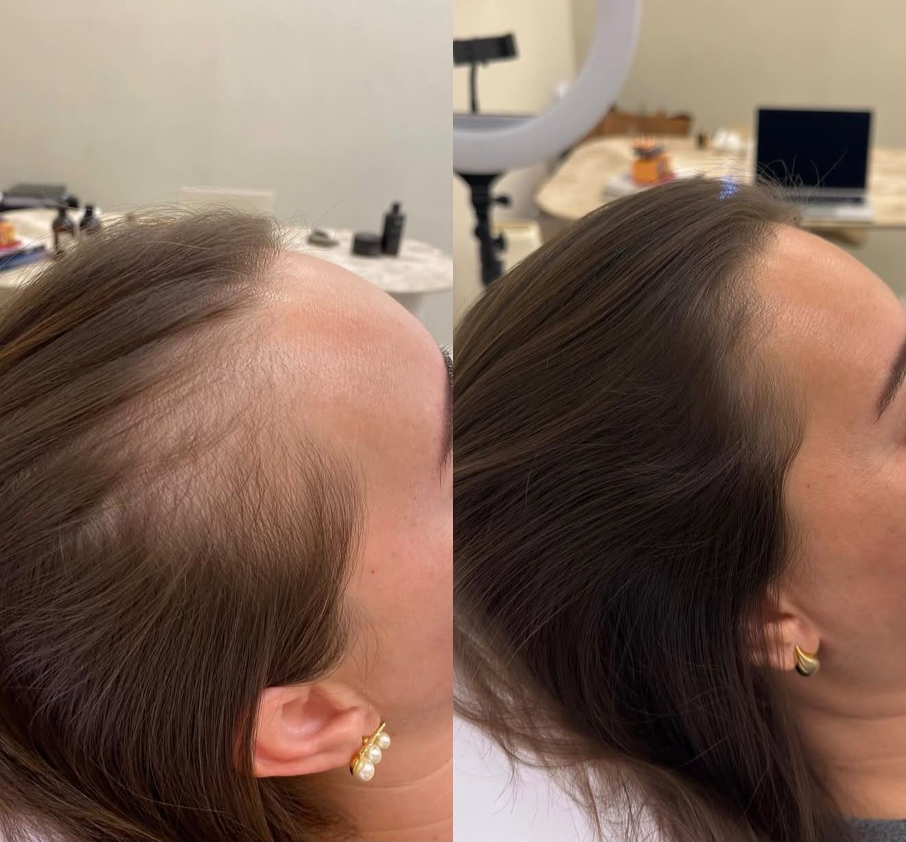Antes e depois: Saúde Capilar