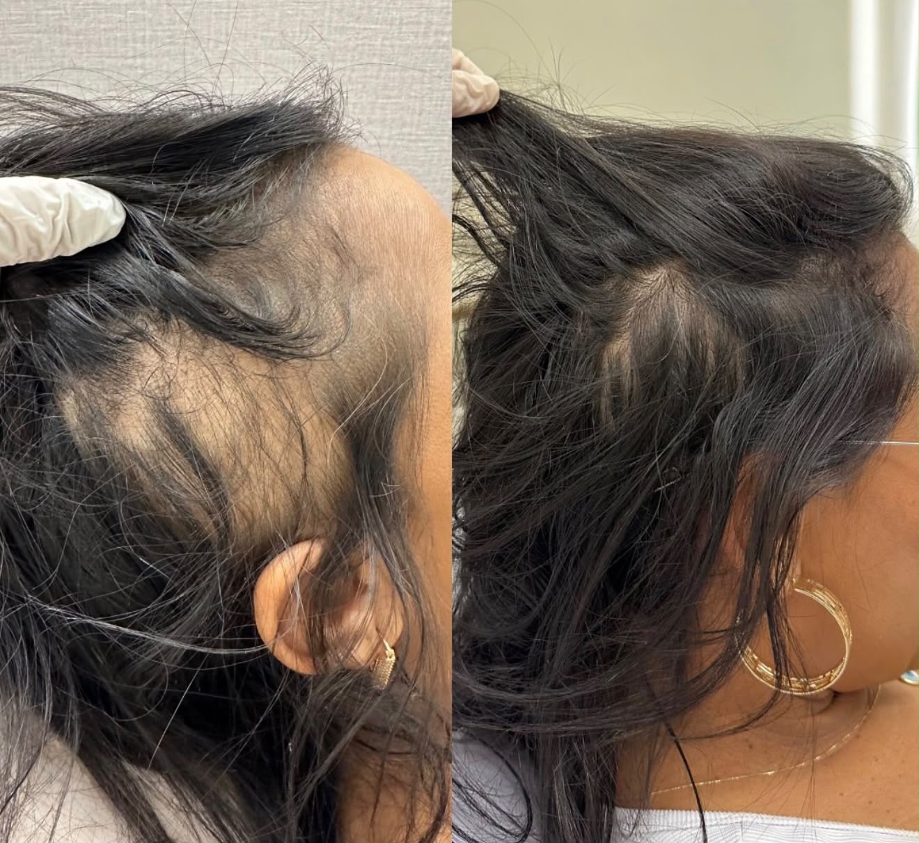 Antes e depois: Saúde Capilar